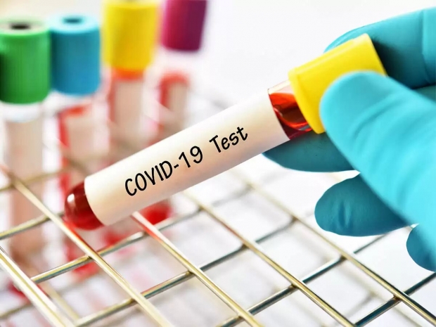 24 сотрудника ТРК «Казахстан» заразились COVID-19