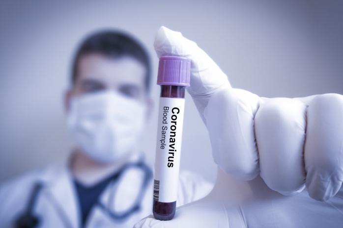 Эксперт рассказал о «вирусовыделении» у излечившихся от COVID-19